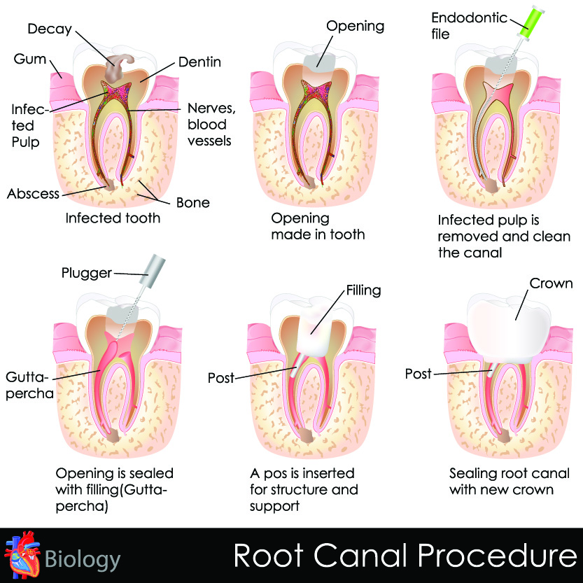 Lake Street Dental | Invisalign reg , Emergency Treatment and Pediatric Dentistry