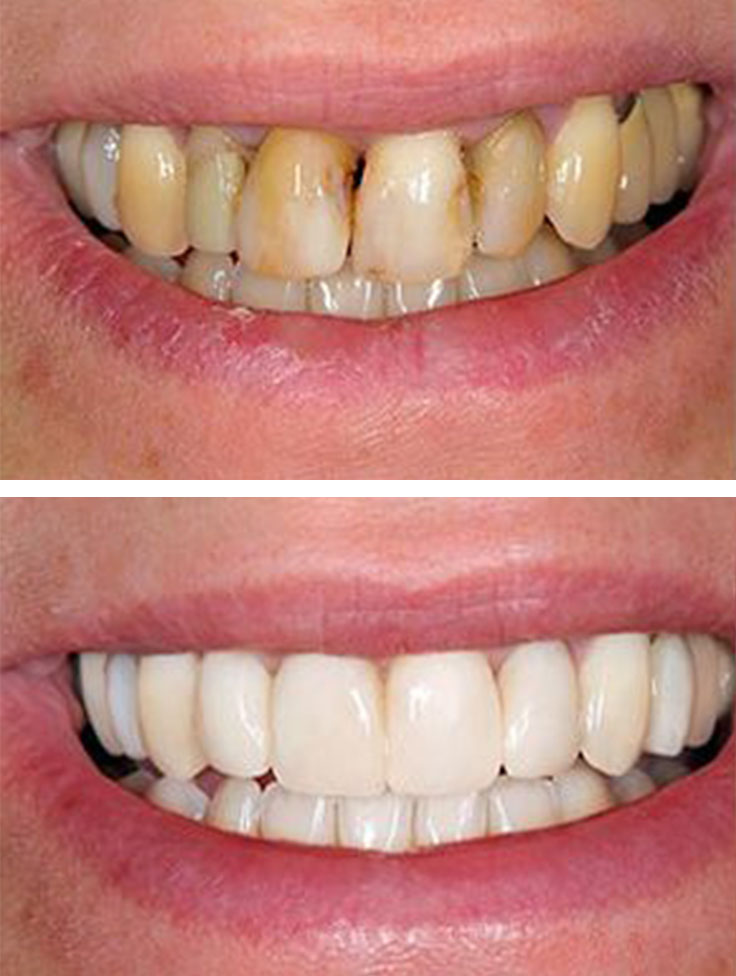 Lake Street Dental | Emergency Treatment, Periodontal Treatment and Teeth Whitening