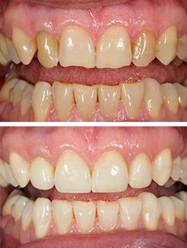 Lake Street Dental | Pediatric Dentistry, Sleep Apnea and Cosmetic Dentistry